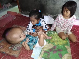 Dua Bocah Sidoarjo Putus Sekolah, Demi Merawat Adik Penderita Hydrocephalus