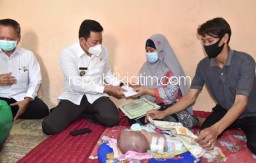 Pemkab Sidoarjo Fasilitasi Pengobatan Bayi Nayla Asal Gedangrowo Prambon Penderita Hidrosefalus dan Spina Bifida