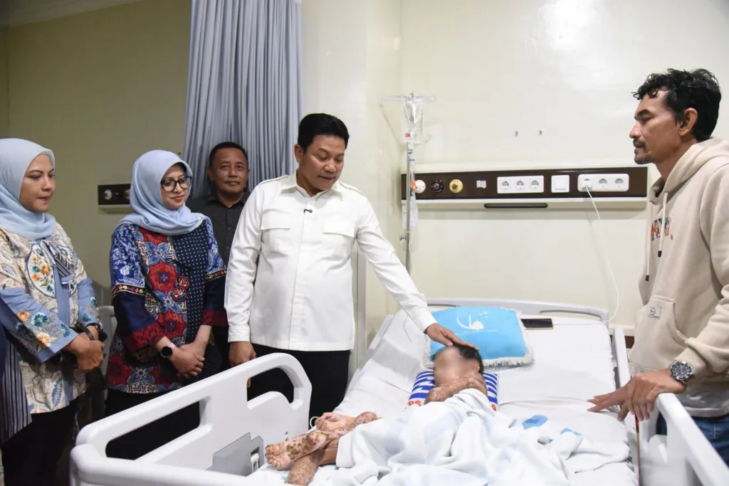 Kisah Pilu M Izzan Korban Kebakaran yang Kini Dimentori Langsung Pemkab Sidoarjo Dirawat di RSUD RT Notopuro