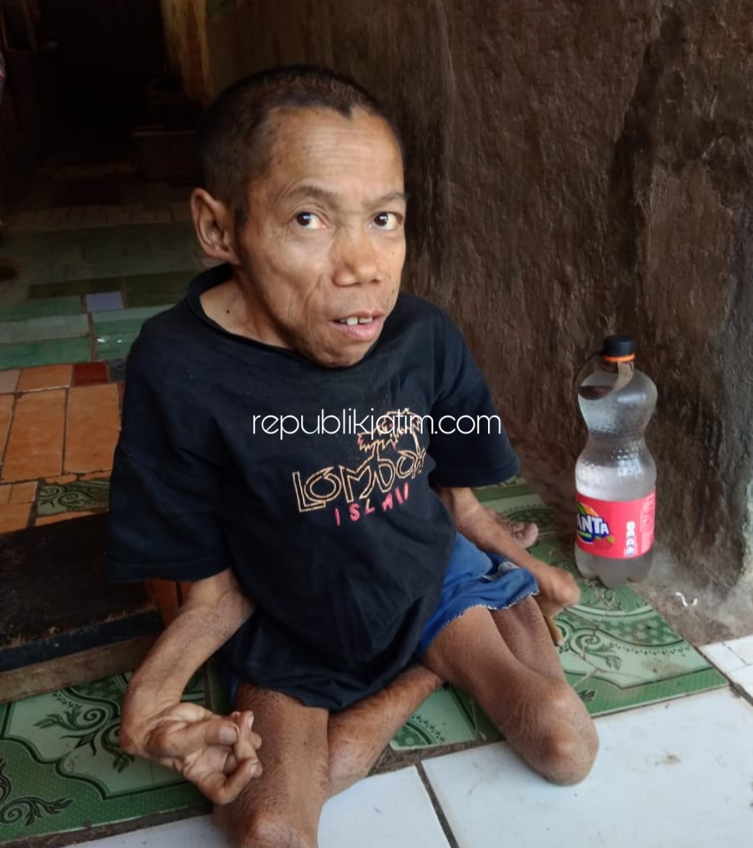 TAK TERSENTUH BANTUAN - Kadimun (43) penyandang cacat fisik warga Gluduk, Dusun Munung ,Desa Munggu Kecamatan Bungkal, Ponorogo tak pernah tersentuh bantuan pemerintah, Sabtu (09/11/2019).