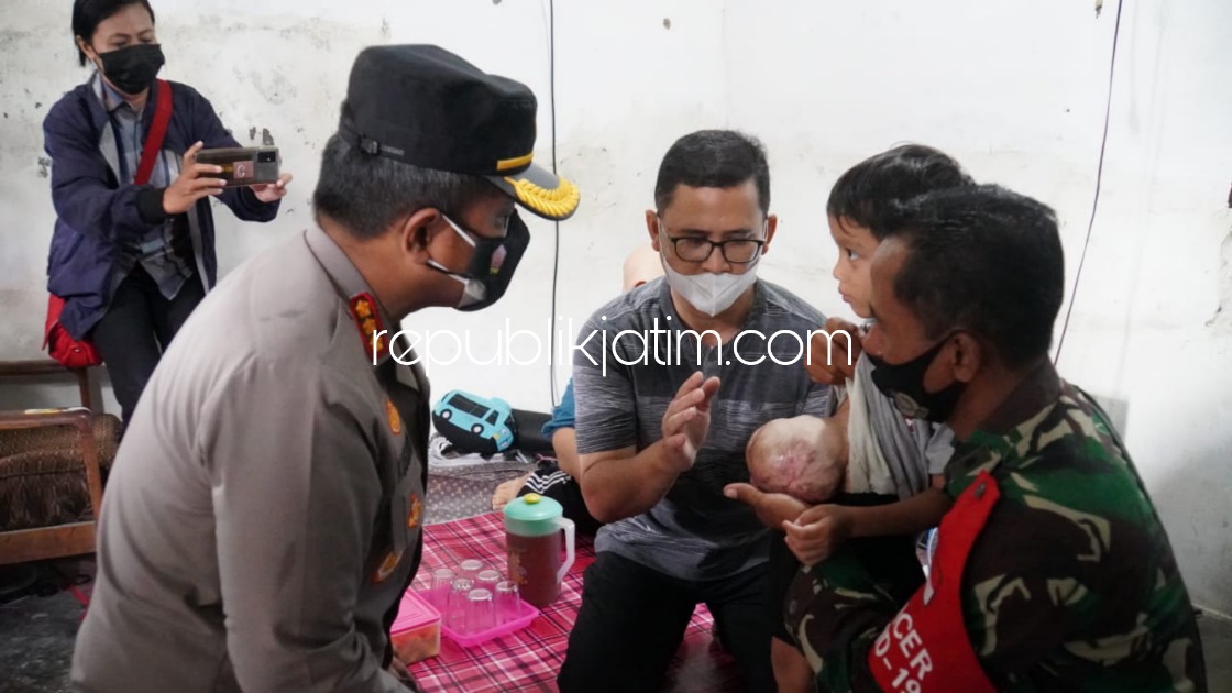 JENGUK - Kapolresta Sidoarjo Kombes Pol Kusumo Wahyu Bintoro membesuk Ahmad Rizal (5) di Desa Kedensari, Kecamatan Tanggulangin, Sidoarjo yang menderita Gastroschisis, atau kelainan sejak lahir dengan usus berada di luar tubuh, Jumat (18/02/2022).