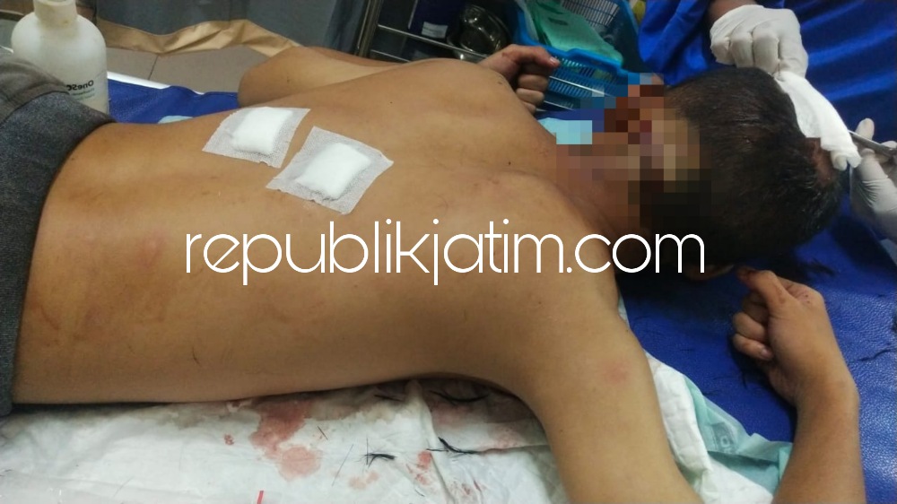 TERLUKA - Korban begal MFH (17) warga Kecamatan Sedati, Sidoarjo saat mendapatkan perawatan tim medis atas sejumlah luka yang dideritanya akibat dianiaya dan dibacok begal di kawasan Frontage Road Aloha, Kecamatan Gedangan, Sidoarjo kemarin.
