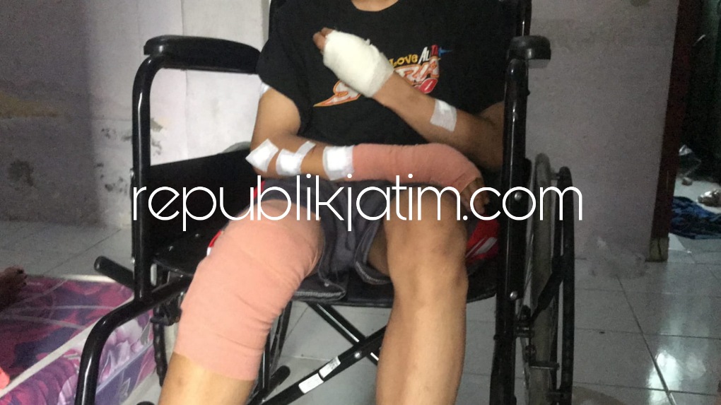 LUKA - Kondisi korban pengeroyokan DPW (16) warga Kecamatan Taman, Sidoarjo yang sekujur tubuhnya dipenuhi luka dan dibalut perban usai dirawat di rumah sakit karena luka akibat dikeroyok massa, Rabu (09/11/2022). 