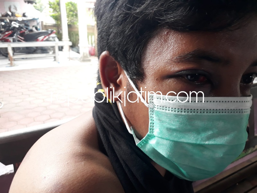 KORBAN - Sebanyak dua pemuda harus rela menjadi sasaran pelaku pencurian dengan kekerasan (Curas) di JL Raya Lajuk, Kecamatan Porong, Sidoarjo, Senin (27/03/2023) dini hari.