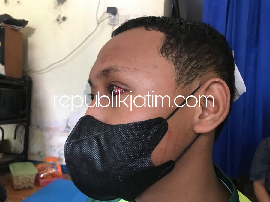 TERLUKA - Korban penganiayaan, BW (17) warga Desa Jemundo, Kecamatan. Taman yang diduga dianiaya gengster di JL Raya Desa Bangsri, Kecamatan Sukodono mengalami luka di mata dan kepalanya, Kamis (06/04/2023) dini hari.