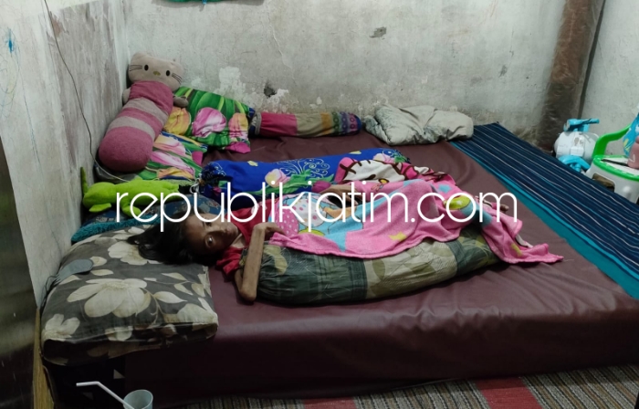 KUNJUNGI - Plt Bupati Sidoarjo, Subandi mengunjungi penderita TBC Paru, Luky Apriliasari (22) warga Desa Siwalanpanji, Kecamatan Buduran, Sidoarjo agar segera mendapatkan pengobatan yang layak secara medis, Jumat (31/05/2024).